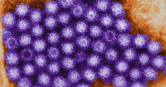 A purple rendering of a colony of norovirus against a brown to yellow background.