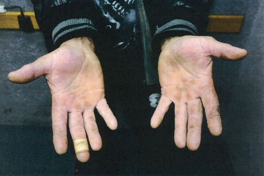 Darren Ashley's hands