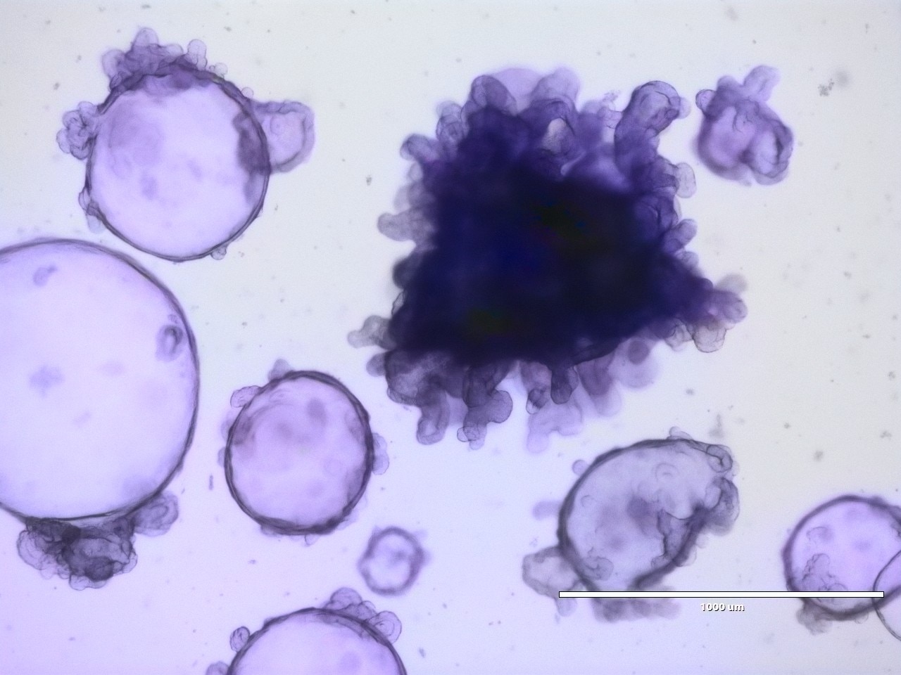 Melbourne researchers create intestinal models to research inflammatory bowel disease