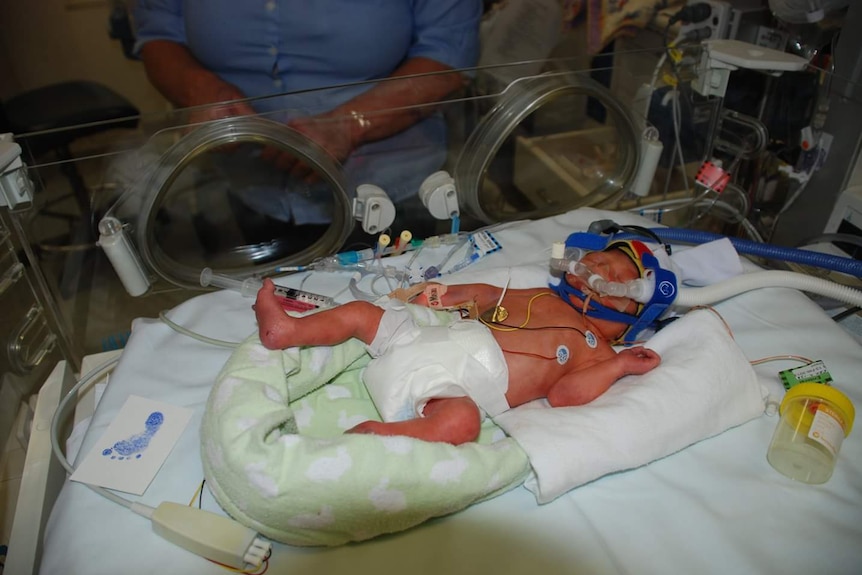 Premature baby hooked up to a CPAP machine in a humidicrib.
