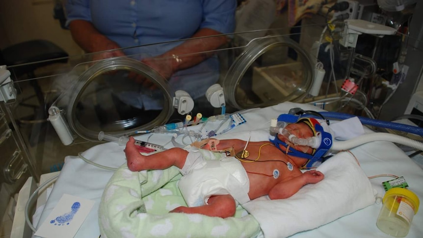 Premature baby hooked up to a CPAP machine in a humidicrib.
