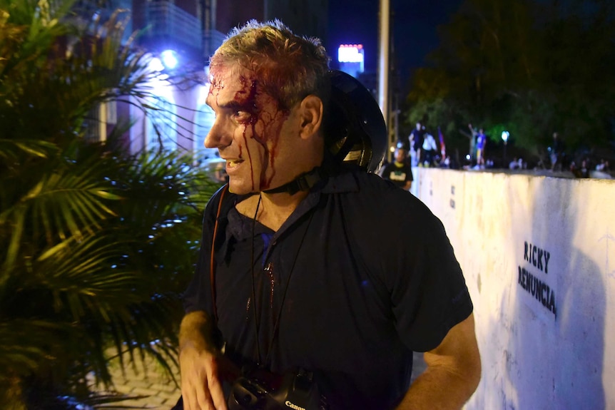 A man wearing a black polo shirt and holding a camera bleeds profusely from above his left eye.