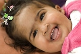 Recovering: one of the twins, Trishna