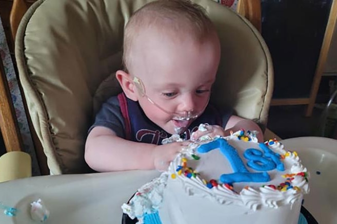 Baby with breathing tubes in his nose blowing out candles on his first birthday cake. 