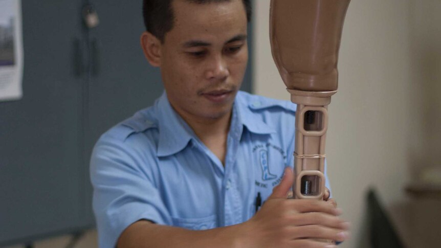 A prosthetics worker makes an artificial leg for a UXO victim or otherwise disabled person