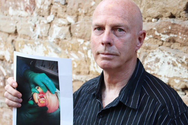 Tasmanian paramedic Nick O'Brien with photo of his injury.