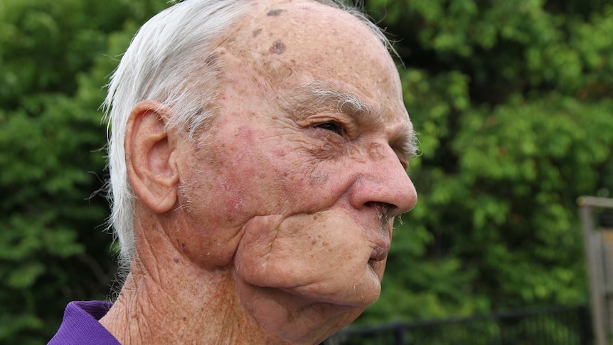 A man's face with a disfigured jaw