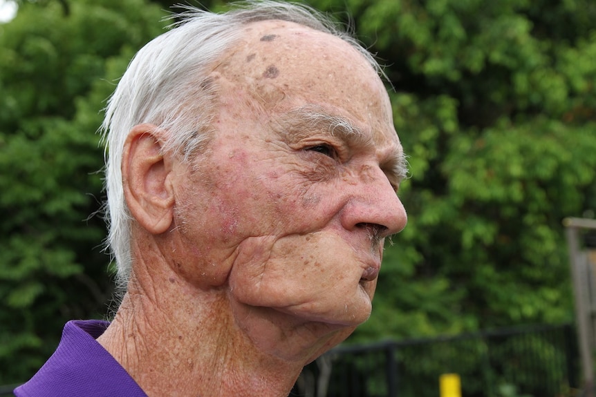 A man's face with a disfigured jaw