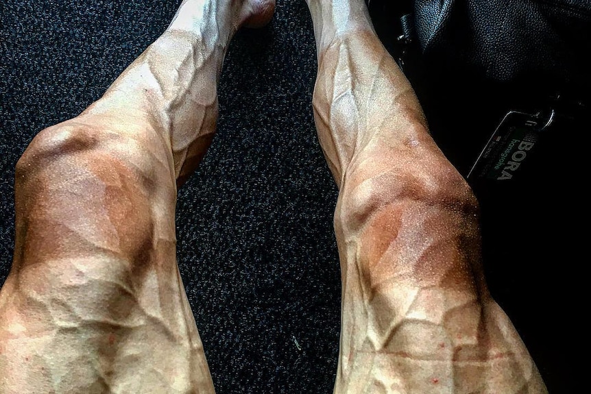 Pawel Poljanski's veiny legs