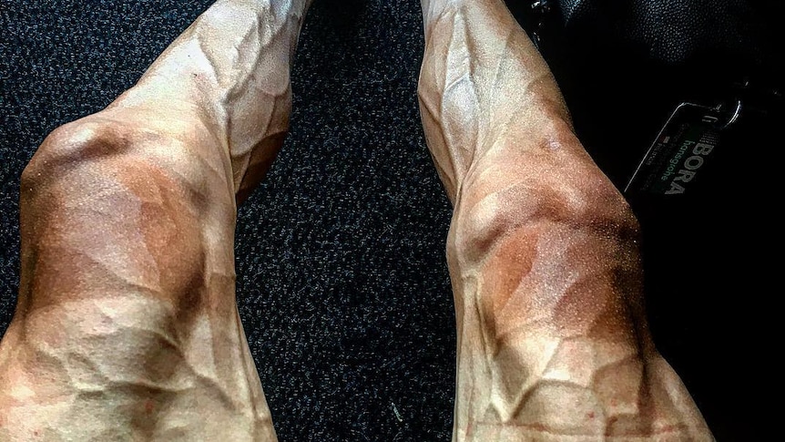 Pawel Poljanski's veiny legs