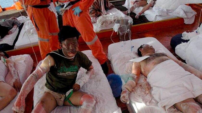 Asylum seekers are treated for burns after the explosion.