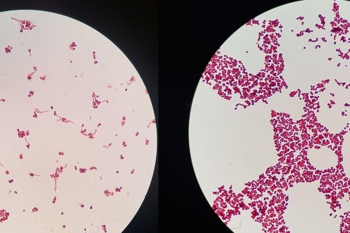 Petri dishes showing bacteria present in sports shoes after use