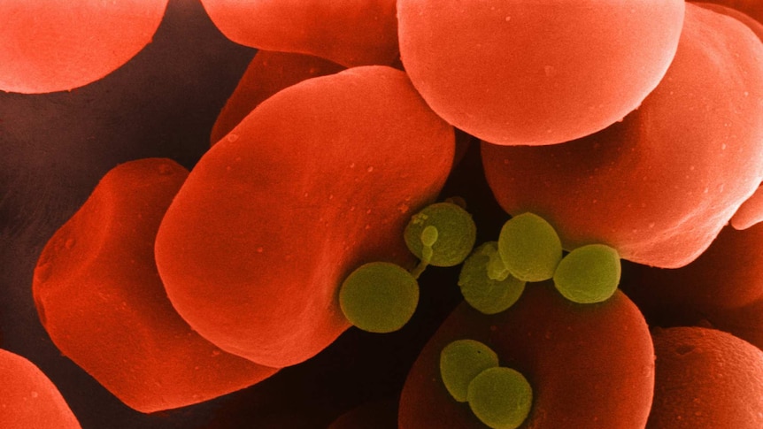 A graphic of red blood cells and yellow-green bacteria representing sepsis
