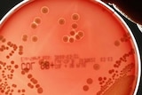 A hand holds a petri dish containing the MRSA