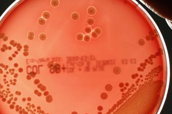 A hand holds a petri dish containing the MRSA