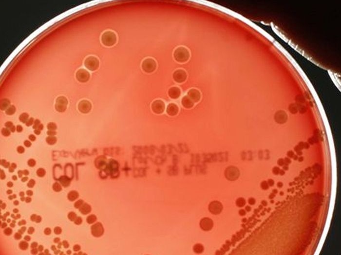 A hand holds a petri dish containing the MRSA