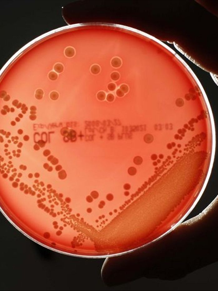 A hand holds a petri dish containing a bacteria strain.
