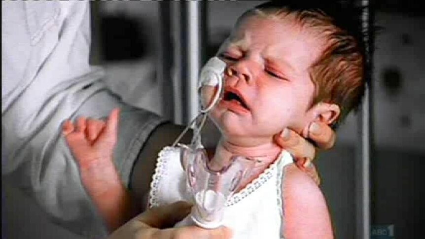 An infant with tubes connected to its face is crying.