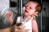 An infant with tubes connected to its face is crying.