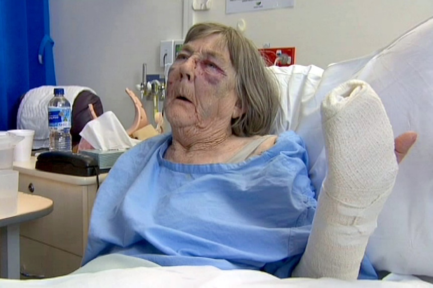 An elderly woman is hospital after a violent car theft at St Albans