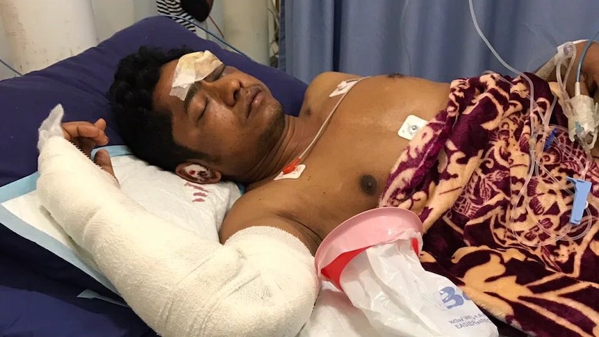 Rohingya Muslim refugee, Abu Bakar refugee was injured in a road accident on Nauru.