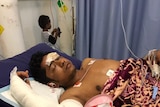 Rohingya Muslim refugee, Abu Bakar refugee was injured in a road accident on Nauru.