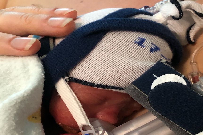 Premature baby Rafferty Robb with mother Alana Wilkinson holding him