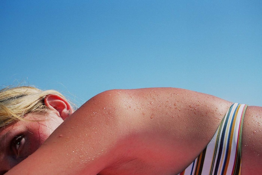 melanotan acne Dangerous' tanning products promoted by influencers Melanotan II Peptide | Elite