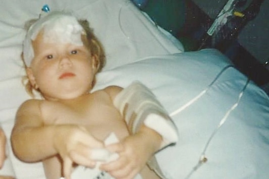 A toddler with a frown in a hospital bed, tubes coming out of her head and bandages on her head and arm.