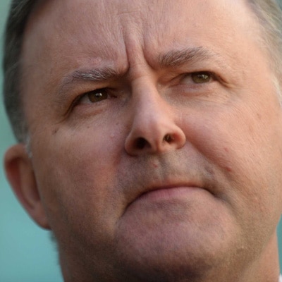 Anthony Albanese.