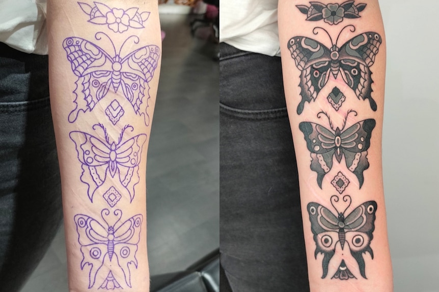 Three individual butterfly tattoos in a vertical row cover self-harm scarring on a young person's arm 