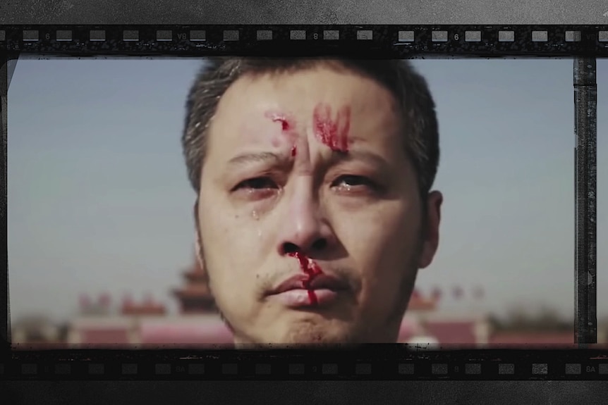 An old reel of film featureing a man with blood on his face 