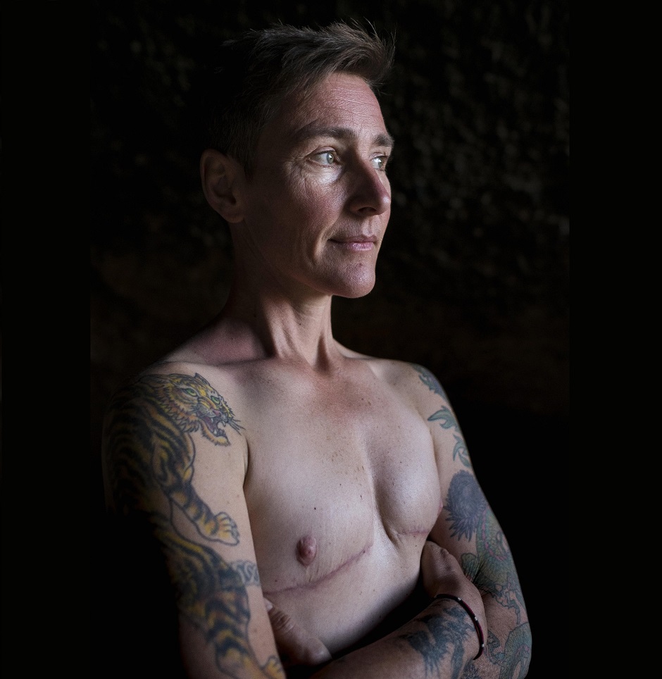 Eddie Ayres shirtless, showing the mastectomy scars on his chest.
