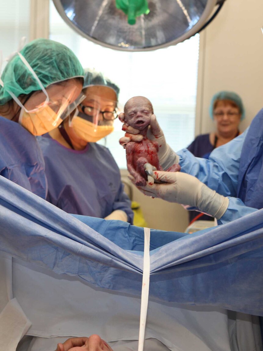 Doctors hold a premature baby in a surgical theatre.