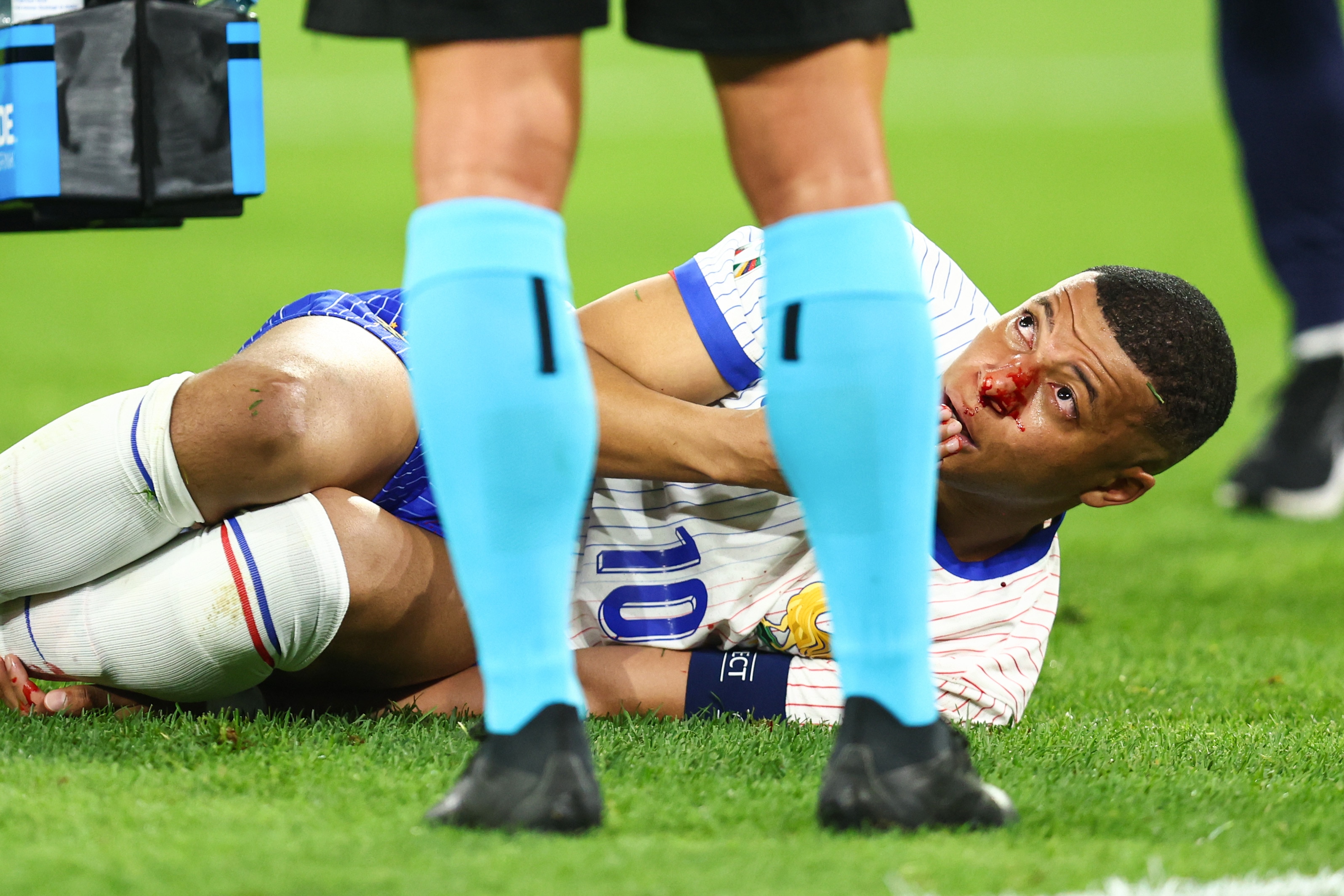 Euro 2024 five quick hits: Kylian Mbapp&eacute; suffers facial injury as two  upsets shake up tournament - ABC News