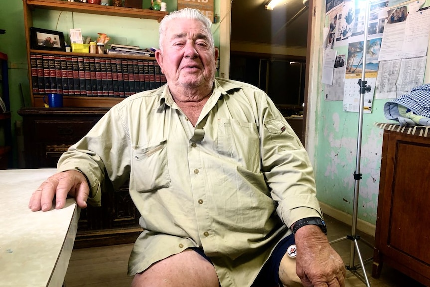 A man with a prosthetic leg sits at a table.