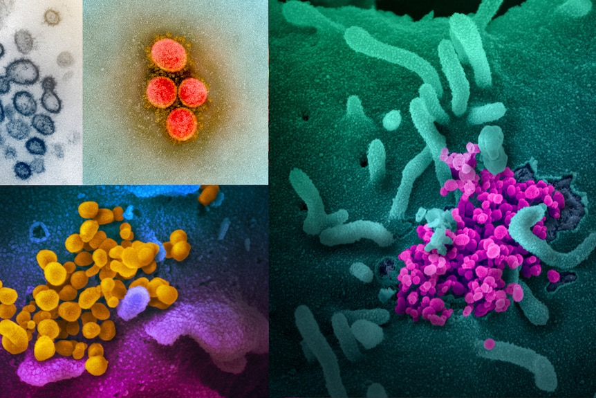 A composite of images of viruses created by NIAID