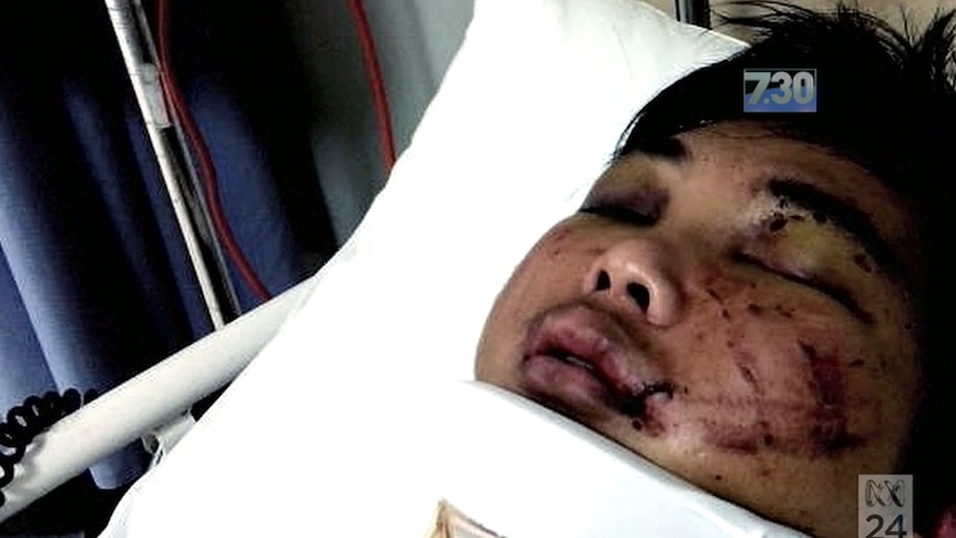 Bashing victim Minh Duong in hospital