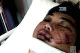 Bashing victim Minh Duong in hospital