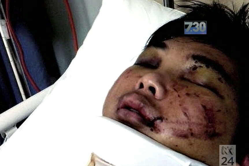 Bashing victim Minh Duong in hospital in 2012