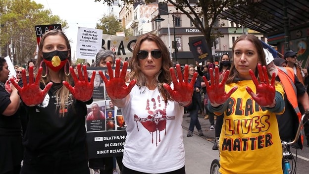 Three women with blood on their hands