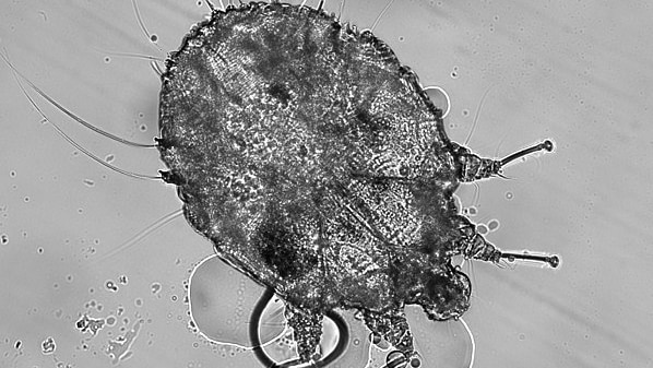 microscopic scabies mite