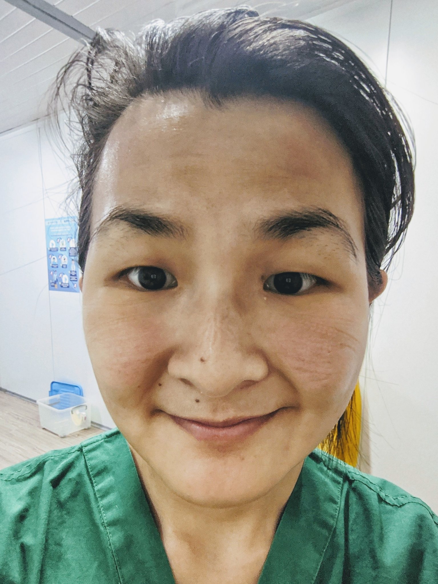 A female doctor takes a selfie with markings on her face from goggles