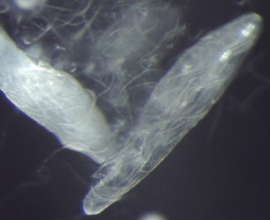 Microscope image of nematode eggs