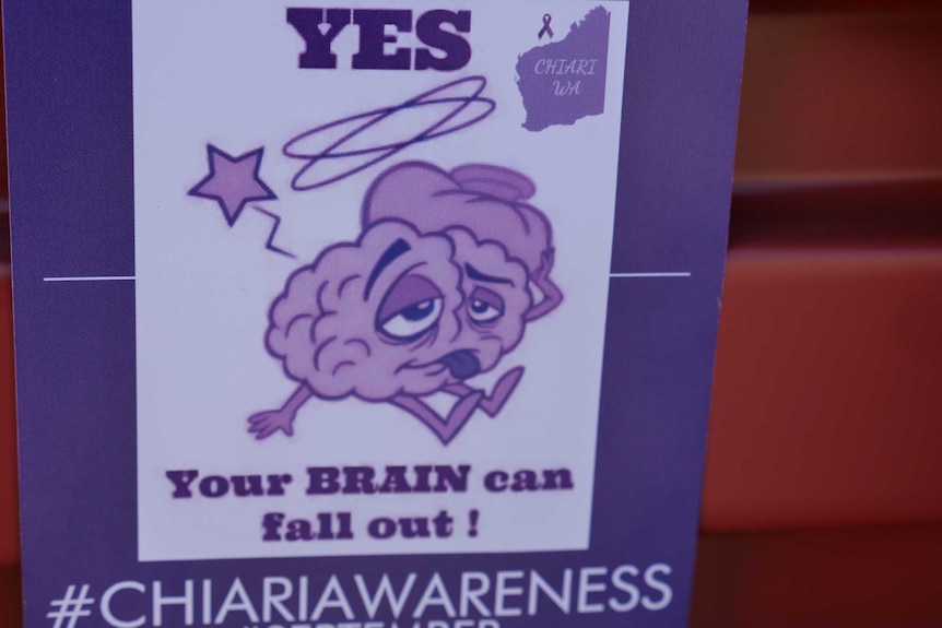 A flyer with purple writing saying 'yes, your brain can fall out'.