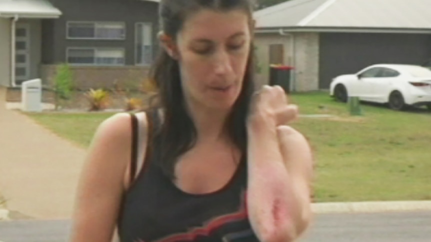 Renee Harris scraped her elbow trying to escape from the kangaroo