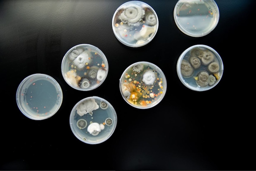 Petri dishes