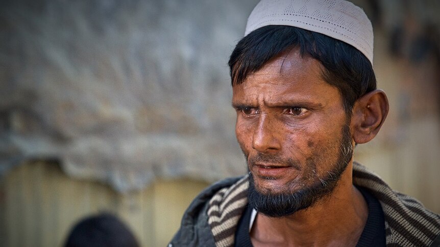 A Rohingya man looks distressed.