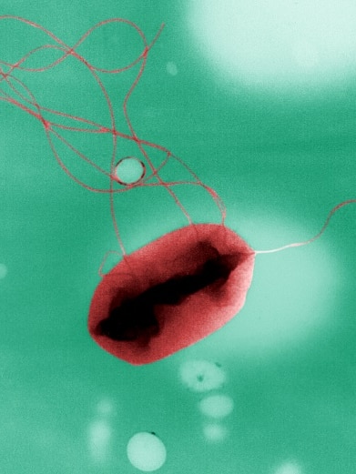 E coli showing multiple flagella