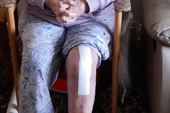 A woman sits in a chair with a plaster on her left knee